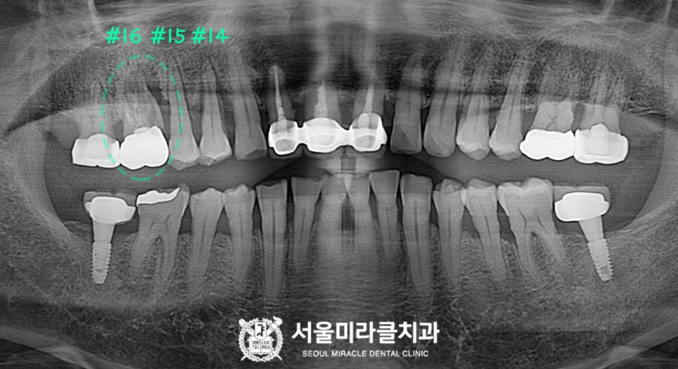 방사선 영상 1