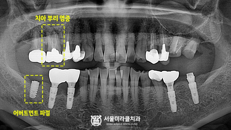 방사선 영상 4