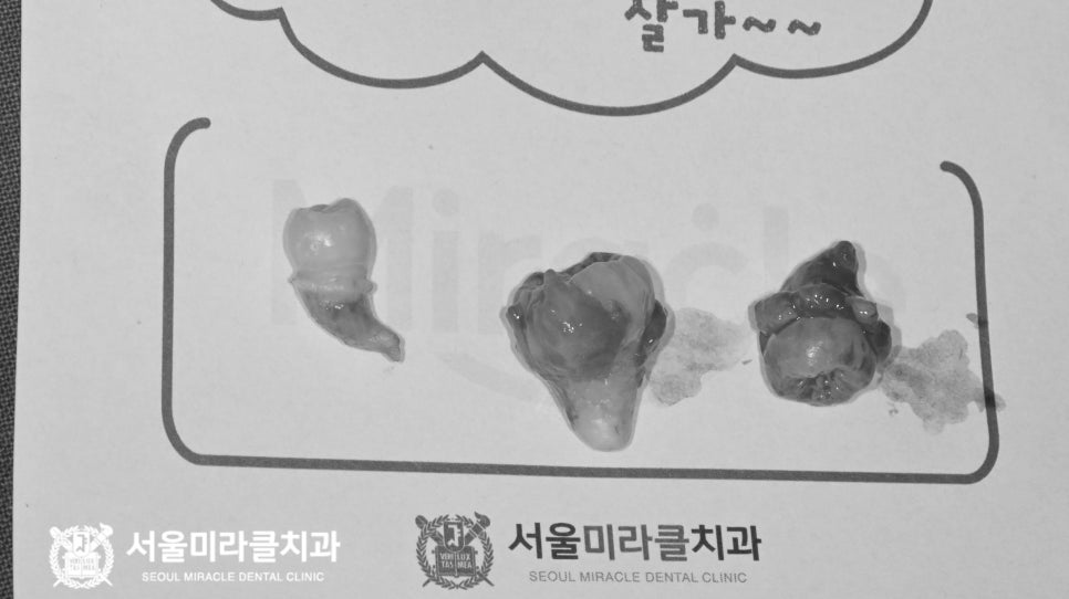 방사선 영상 2