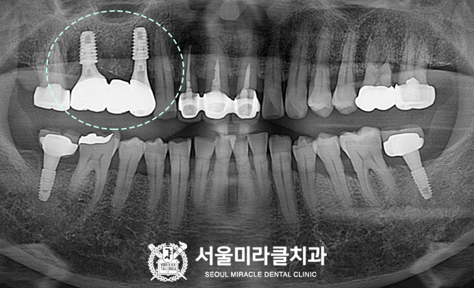 방사선 영상 6