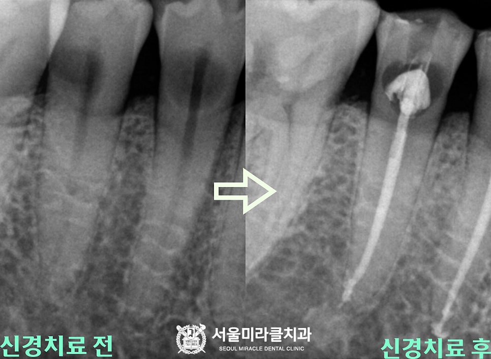 방사선 영상 5