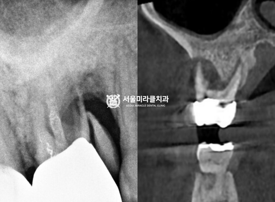 방사선 영상 2