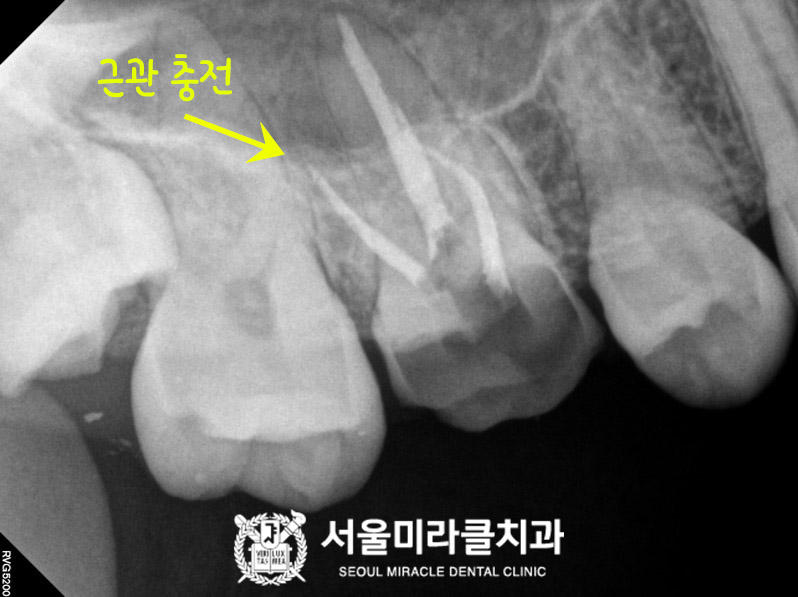 방사선 영상 6