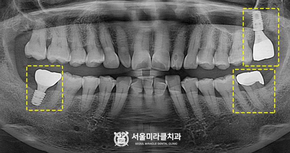 방사선 영상 2