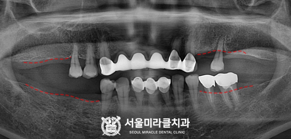 방사선 영상 5