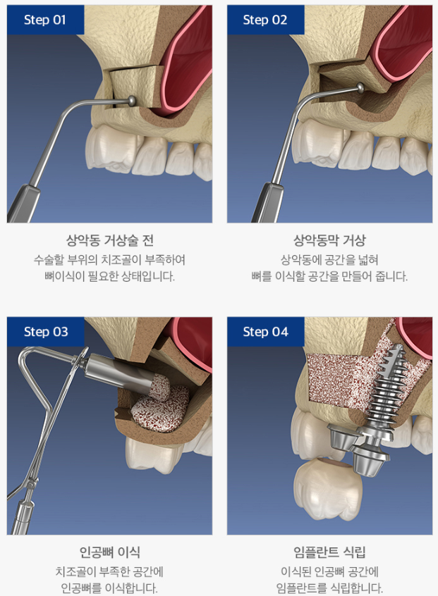 구강 사진 1
