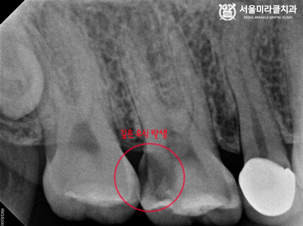 방사선 영상 2
