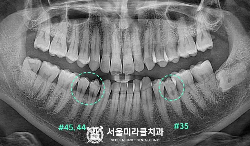 방사선 영상 4