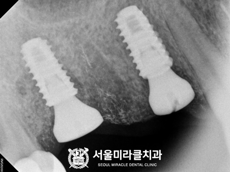방사선 영상 5