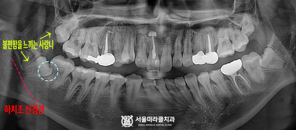 방사선 영상 1