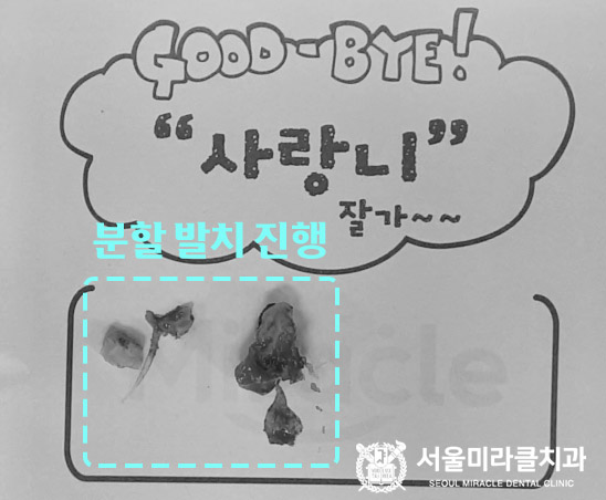 방사선 영상 4