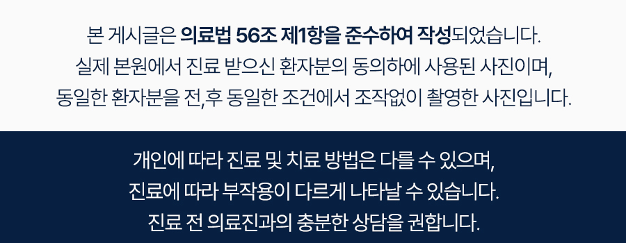구강 사진 4