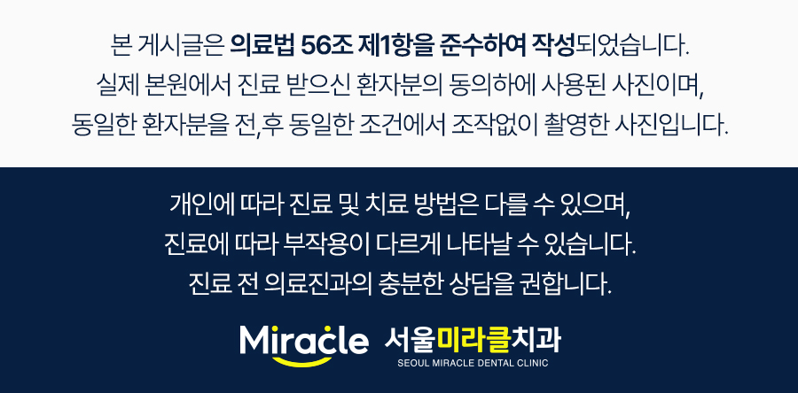구강 사진 7