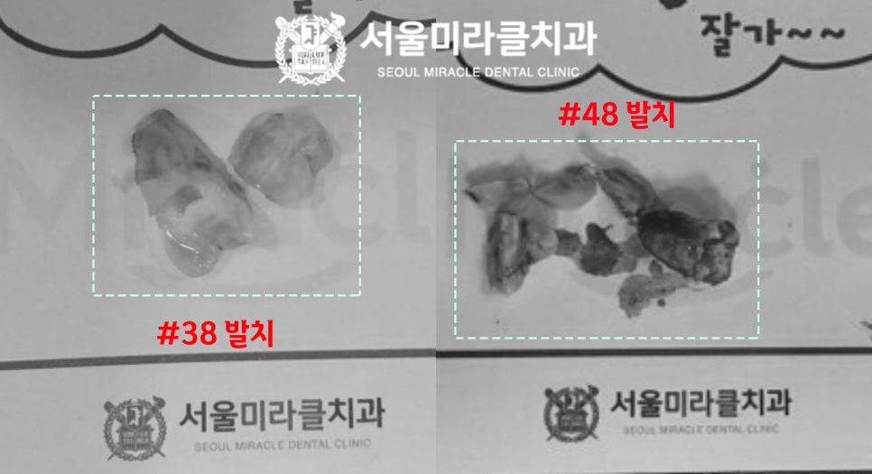 방사선 영상 3