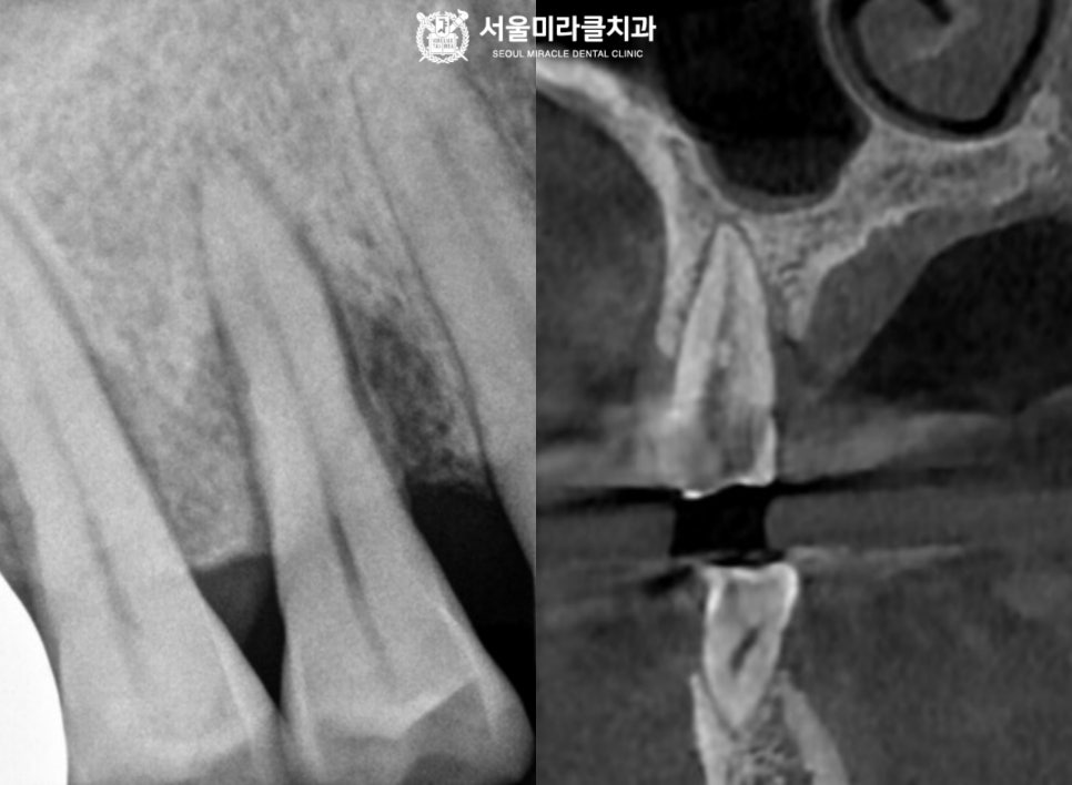 방사선 영상 3
