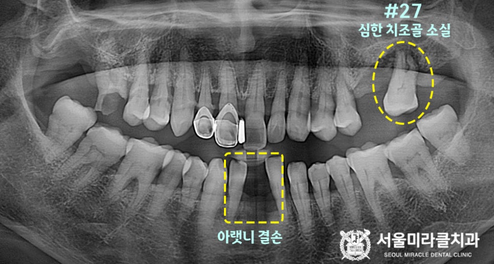 방사선 영상 1