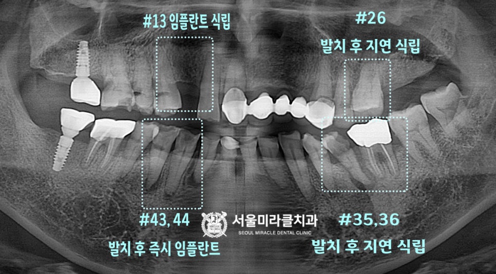 방사선 영상 4