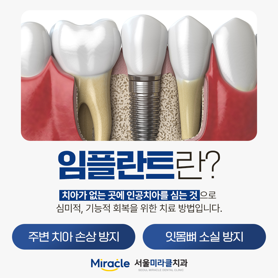 산본치과에서 보는 잇몸뼈 상태와 검사 절차 — 산본임플란트 상담 기준