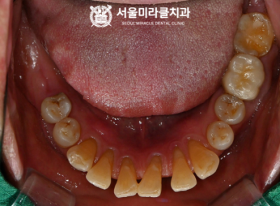 검사
