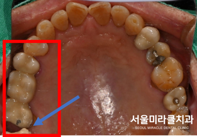 반복