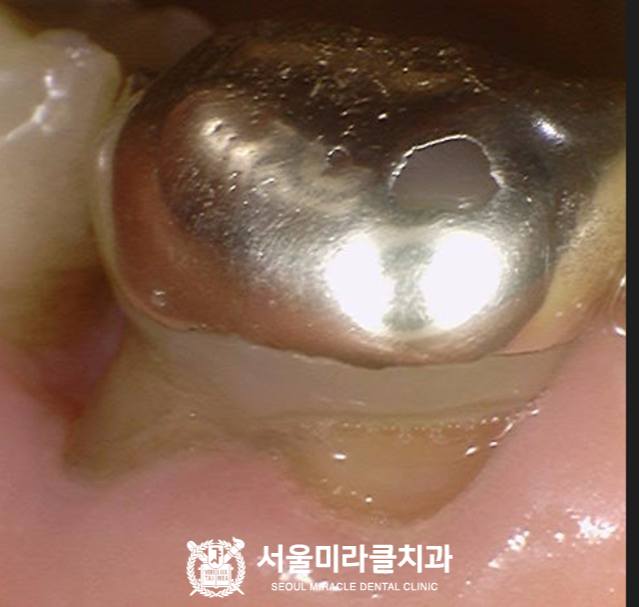 검사