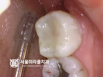 평가