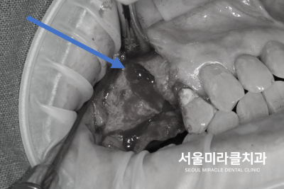 검사
