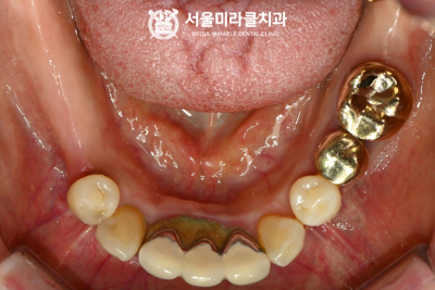 호흡자세조절
