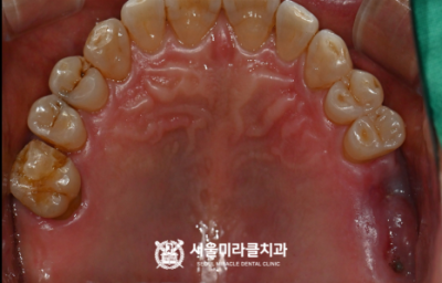 연결부품