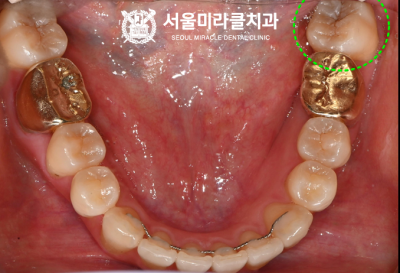 재점검