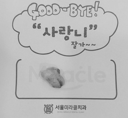 발치 치아 확인