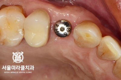 검사 장면