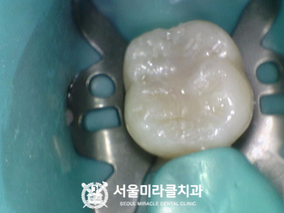검사 장면