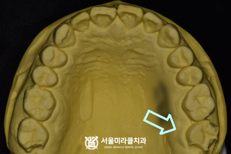 재료반응