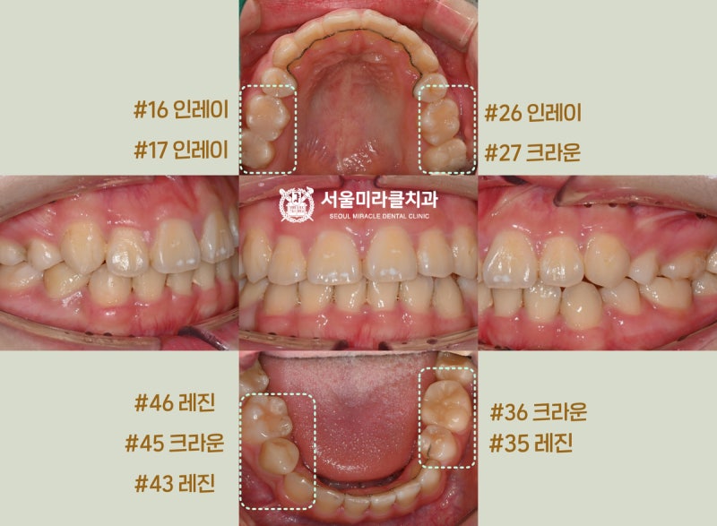 보호자