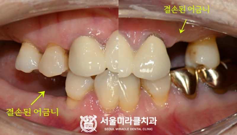 사전문진확인